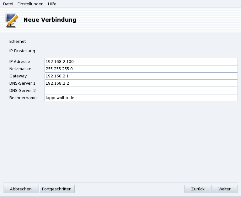 Eingabe statischer LAN-Verbindungsparameter